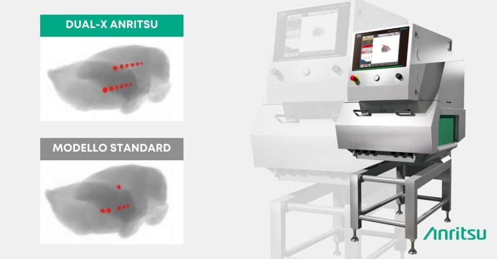 Sistema a Raggi-X Anritsu